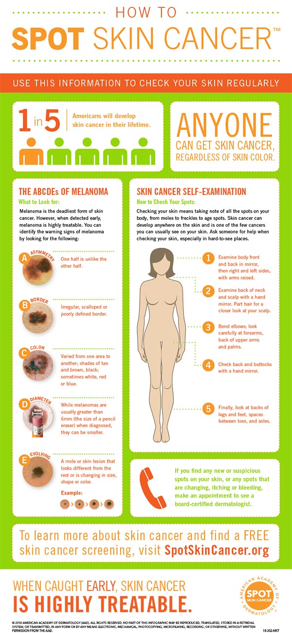 spot skin cancer chart