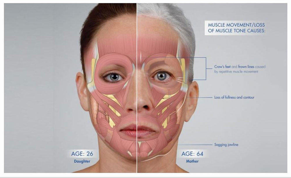 muscle structure facial